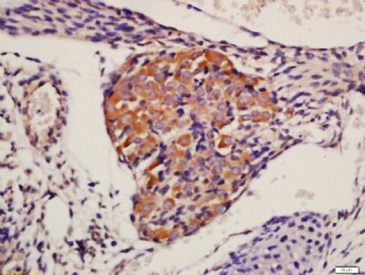 AKT1+2+3蛋白激酶AKT1,2,3抗体