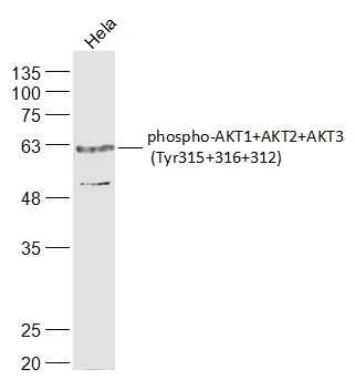 phospho-AKT1+AKT2+AKT3 (Tyr315