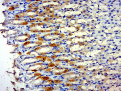 Phospho-PSD95 (Tyr236 + Tyr240