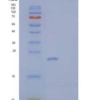 人存活素(Surv)重组蛋白