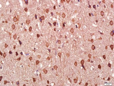 Tau微管相关蛋白单克隆抗体