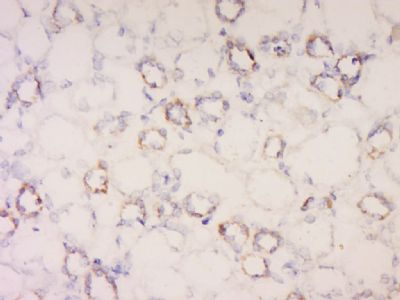 ATPase Na+/ K+ beta 2钠钾ATP酶通道蛋