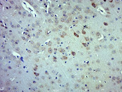 GAD65谷氨酸脱羧酶-65抗体