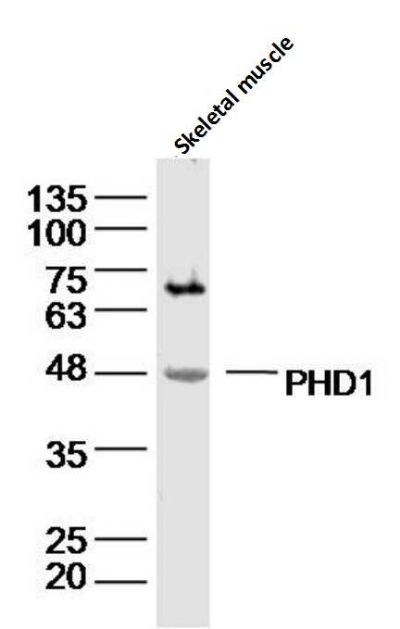 PHD1脯氨酰羟化酶抗体
