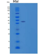 人ST6唾液酸转移酶2/ST6GalNAc2重组蛋白C-6H