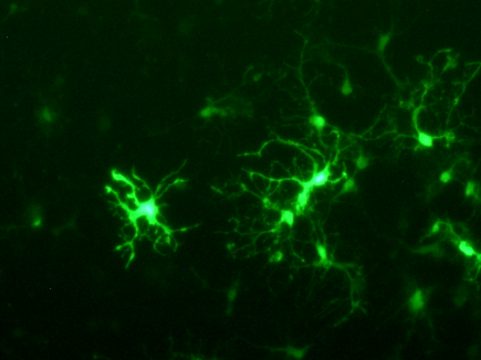JetMESSENGER - Neuron fluorescence