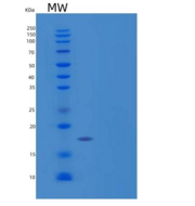 人G-CSF / CSF3重组蛋白isoform b