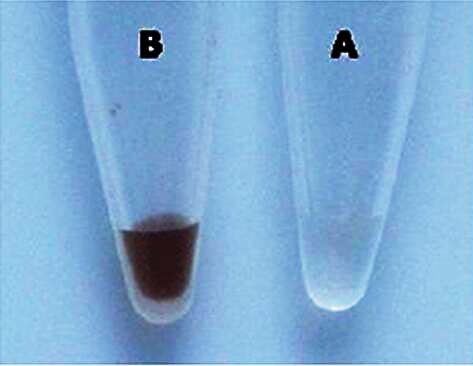 柱式腐殖酸清除剂