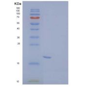 人囊泡相关膜蛋白相关蛋白B重组蛋白