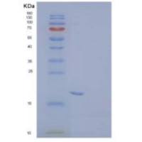 人囊泡相关膜蛋白相关蛋白B重组蛋白