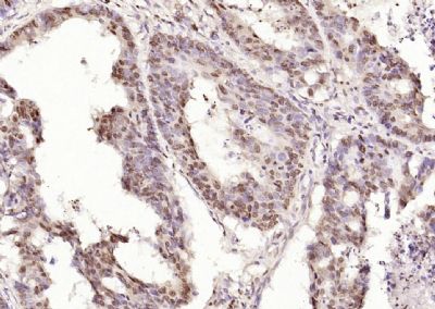 CIDEC细胞死亡活化蛋白抗体