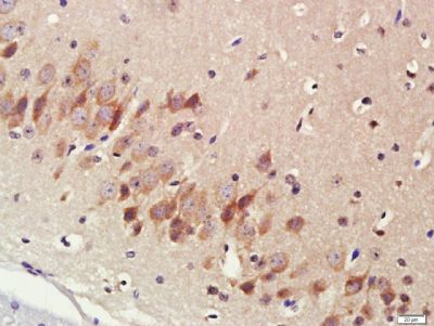 CYP17细胞色素P450 17抗体