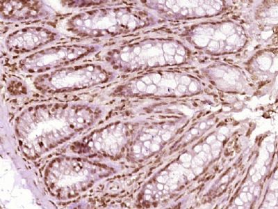 hnRNP A2B1异质核糖核蛋白hnRNPA2抗体