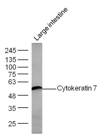 Cytokeratin 7 antibody