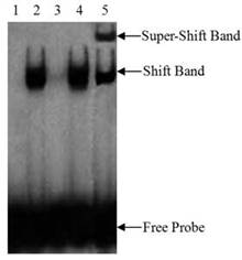 ARE凝胶迁移突变探针(1.75μM)