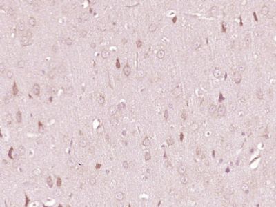 色氨酸羟化酶抗体TPH