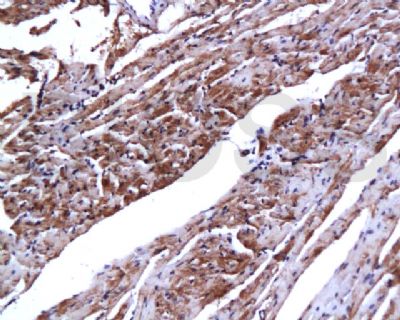 Cardiac Troponin I/TNNC1心肌肌钙蛋白