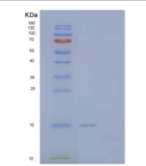人微管关联蛋白1轻链3α(MAP1LC3a)重组蛋白C-6H