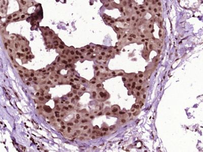 HSP70热休克蛋白70抗体