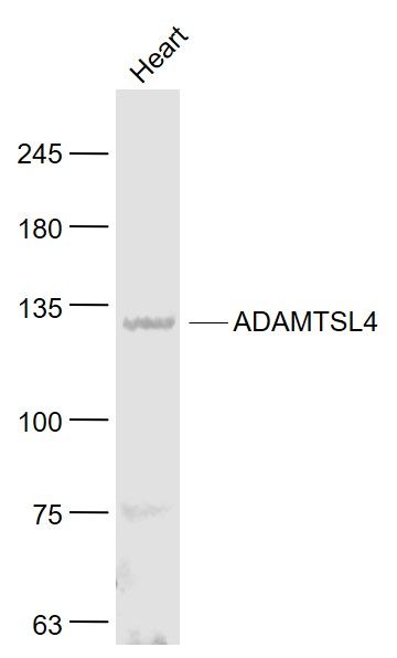 ADAMTSL4整合素样金属蛋白酶与凝血酶样4蛋白抗体