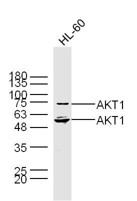 AKT1蛋白激酶B抗体