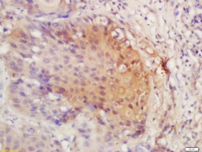 PIRH2泛素连接酶抗体