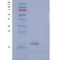 人CD40配体/CD40L/TNFSF5重组蛋白