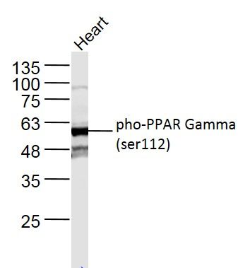 Phospho-PPAR Gamma (Ser112) an