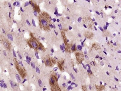 Integrin beta 1整合素β1/Integrin 