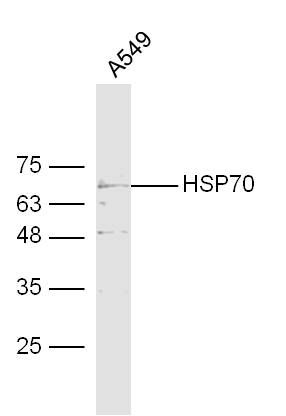 HSP70热休克蛋白-70抗体