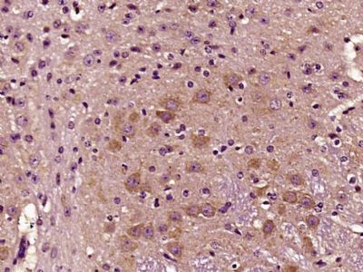 GAT1/GABA Transporter 1 γ氨基丁酸运