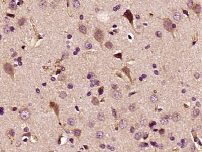 ITCH/AIP4 antibody