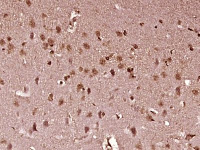 STAT1 p84+p91信号转导与转录激活因子1抗体