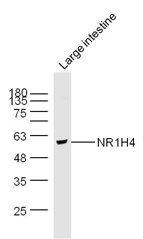 NR1H4 antibody