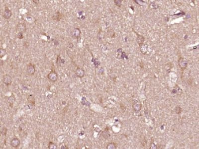 phospho-PTPN6(Tyr564)磷酸化蛋白酪氨酸磷