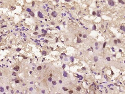 phospho-CK18(Ser52)磷酸化细胞角蛋白18抗