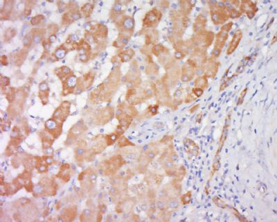 SEC24D转运蛋白SEC24D抗体