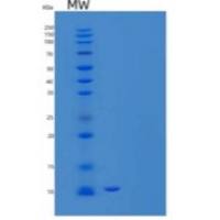 人白介素8(IL8)重组蛋白C-6His