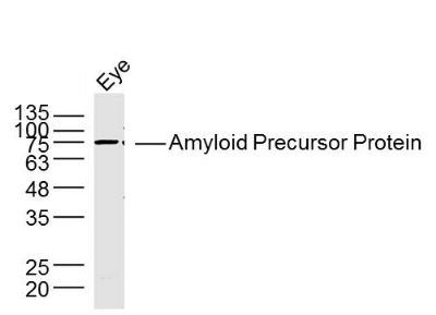 Amyloid Precursor Protein anti