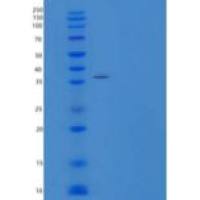 人白细胞介素-6受体亚单位α重组蛋白