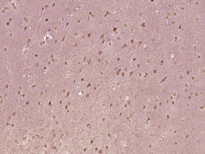 Nucleophosmin antibody