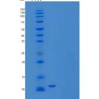 小鼠S100钙结合蛋白B(S100B)重组蛋白重组蛋白C-6His