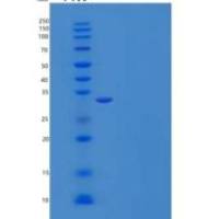 人Ketohexokinase/KHK重组蛋白C-6His