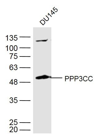 PPP3CC antibody