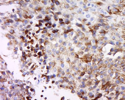 MAGEB3 antibody