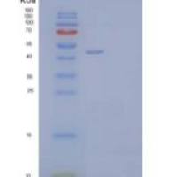 人Testin/TES重组蛋白C-6His