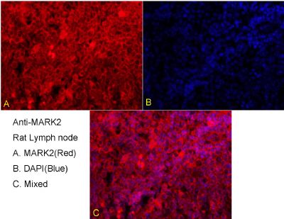 MARK2丝氨酸/苏氨酸蛋白激酶MARK2抗体