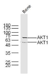 AKT1蛋白激酶B抗体