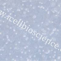 RS4:11、RS4:11细胞、RS411、RS411细胞、人急性淋巴白血病细胞/STR鉴定/镜像