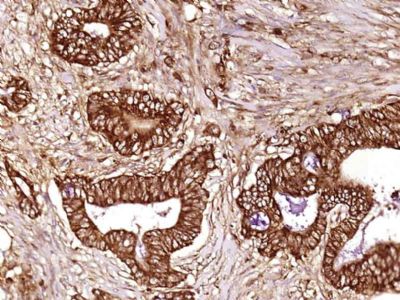 OLFML2B嗅介蛋白样蛋白2B抗体